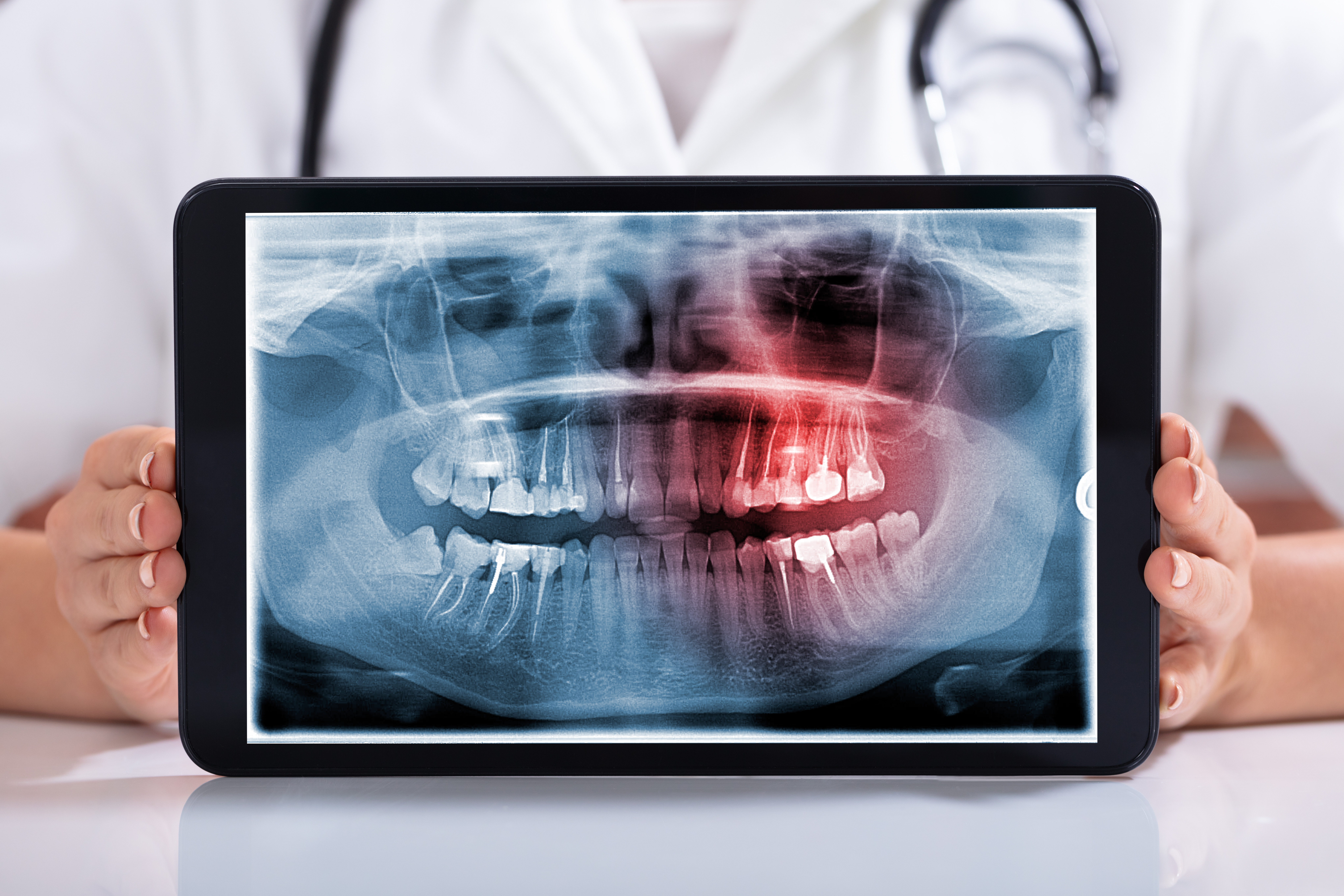 radiografías dentales