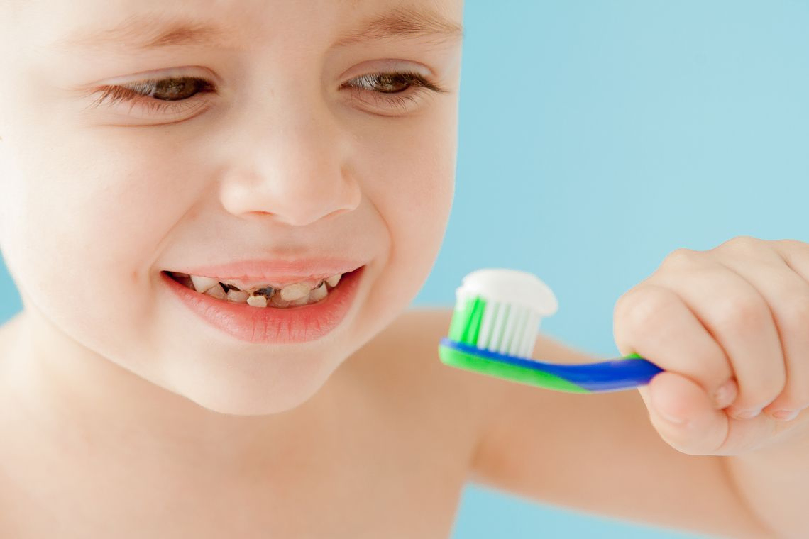 caries Infantiles